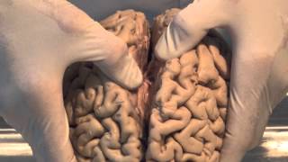 Introduction Neuroanatomy Video Lab  Brain Dissections [upl. by Aldin]