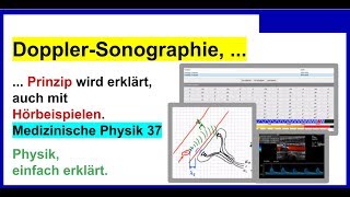 DopplerSonographie Prinzip wird erklärt auch mit Hörbeispiel Für Medizinische Physik 37 [upl. by Nore]