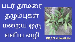 PADARTHAMARAI RINGWORM INFECTION DRSSKUMARAN [upl. by Elbon771]