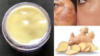 DIY Ginger Cream  Remove Pigmentation Dark Spots amp Acne Scars AntiAging amp Skin Lightening Cream [upl. by Lovel70]