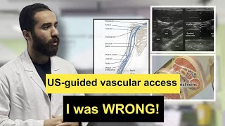 UltrasoundGuided Venous Line Insertion A StepbyStep Guide by Dr Mohammed Ezzat [upl. by Cantu]