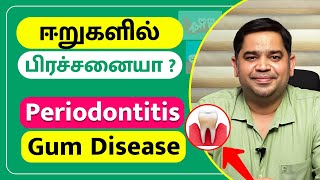 ஈறுகளில் பிரச்சனையா  Periodontitis Gum Disease  Dr Abisheik Johnson Babu  Trinity Dental Clinic [upl. by Ginelle]