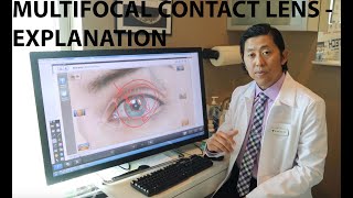 Healthy Eyes Optometry Multifocal Contact Lens Explanation [upl. by Jamel]