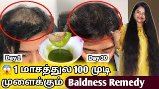 முடி கொட்டி போய் கலக்கமா தெரியுதா Just 30 days போதும்  Best Badness Hair Regrowth Solution at Home [upl. by Topper]