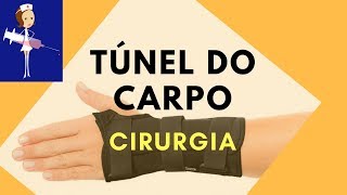 Síndrome do Túnel do Carpo  Cirurgia e Complicações [upl. by Lanita]