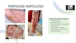 URGENCIAS EN DERMATOLOGIA I [upl. by Milurd]