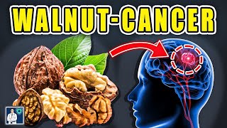 👉Never eat WALNUTS with quotthisquot you will get CANCER and MEMORY LOSS 3 effective solutions Dr John [upl. by Nooj]