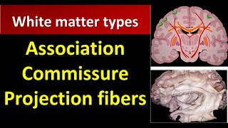 White Matter CNS  Association Commissure Projection fibers [upl. by Jabe]