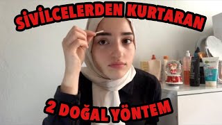 SİVİLCELERDEN 1 GECEDE KURTARAN 2 DOĞAL ÇÖZÜM EVDE [upl. by Nnoj]