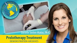 One minute Mortons Neuroma treatment with Prolotherapy [upl. by Meryl759]