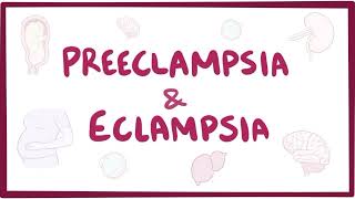 PREECLAMPSIA AND ECLAMPSIA [upl. by Enitnemelc409]