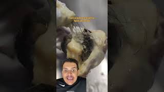 Teratoma com pelos 😱⚰️ anatomiaplena [upl. by Deutsch896]