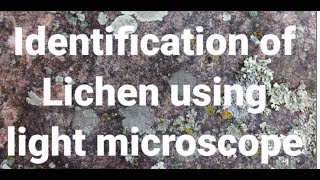 Identification of Lichen using Light microscope [upl. by Blight]