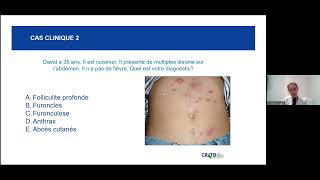 Webinaire infections cutanées bactériennes [upl. by Asle]