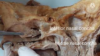 sagittal section of Head neck face [upl. by Naillik]