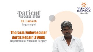 Thoracic Endovascular Aortic Repair TEVAR  Yashoda Hospitals Hyderabad [upl. by Cesar]