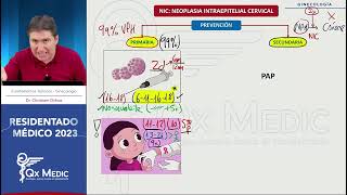 Ginecología  11 Neoplasia intraepitelial cervical [upl. by Lunt703]