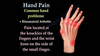 Hand and Finger Pain Common Causes and Symptoms Explained [upl. by Atiuqehc437]