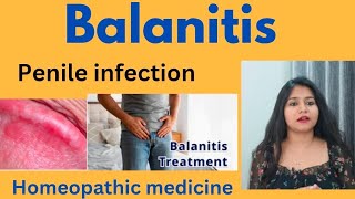 Balanitis penile infection treatment  Balanitis symptomscauses amp homeopathic medicine in hindi [upl. by Sethrida848]