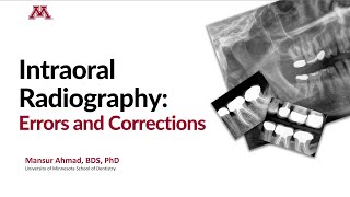 Intraoral Radiography Errors and Corrections [upl. by Soane]