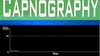 EtCO2 Capnography Part 1 [upl. by Fen]