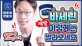 얼굴 주름 팽팽하게 쫙 펴주는 바세린의 놀라운 사용법  바세린 발암물질 논란  바세린 부작용 총정리 [upl. by Ennairam]