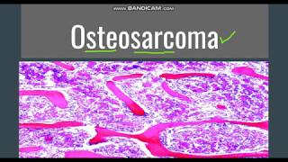 Osteosarcoma GeneralMorphology SubtypesClinical features [upl. by Annavoj]