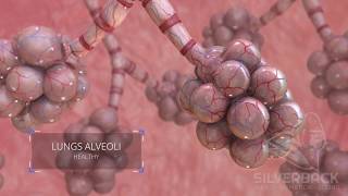 Lungs Alveoli Medical Animation [upl. by Sirovart13]