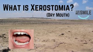 What is Xerostomia [upl. by Naashom7]