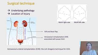 117 Robotic ureteral reimplantation for mid and distal ureter pathology in adults a case serie [upl. by Allemat]