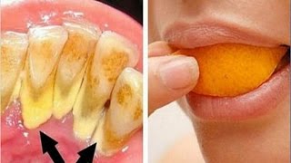 Eliminar el sarro y blanquear tus dientes en 15 minutos con esta receta [upl. by Neelloj]