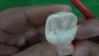 Maxillary Permanent First Molar Morphology [upl. by Pollard]