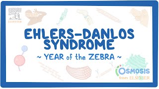 EhlersDanlos syndrome Year of the Zebra [upl. by Gnilrets]