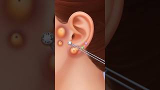 ASMR ear treatment piercing pus clean amp ear pimple removal animation hkASMRtreatment [upl. by Yeh308]