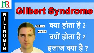 Gilbert syndrome in hindi  Gilbert syndrome causes in hindi  Gilbert syndrome treatment in hindi [upl. by Longtin]