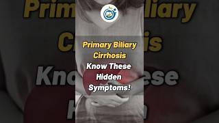 Primary Biliary Cirrhosis Hidden Symptoms cirrosis gastroenterologist viralshorts doctor [upl. by Aynom740]