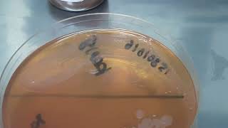 Serratia mercescens growth on broth  Bactec vial and MacConkey agar  Neonatal sepsis [upl. by Wachtel316]