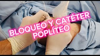 Cómo insertar un CATETER POPLÍTEO [upl. by Atterehs]