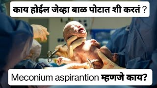 Meconium Aspiration Syndrome explained in Marathi  बाळाने पोटात शी केली [upl. by Warms]