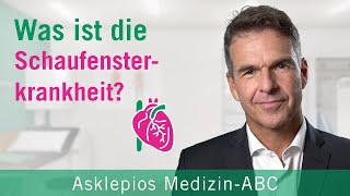 Was ist die Schaufensterkrankheit  Asklepios [upl. by Hare]