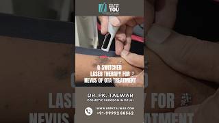 QSwitched Treatment for Nevus Of OTA Procedure  Nevus Of OTA Treatment in Delhi  Dr PK Talwar [upl. by Aneret]