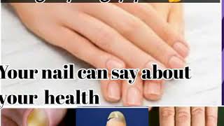 நகங்களும் நோயின் அறிகுறிகளும் nails color changes and health problems [upl. by Lynea]