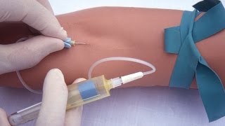 Performing a venipuncture using a butterfly needle [upl. by Chancellor669]