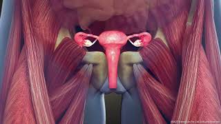 What is Intramural Uterine Fibroid Symptoms and Treatment  3D Guide [upl. by Melissa]