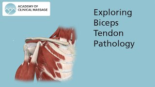 Exploring Biceps Tendon Pathology [upl. by Mccutcheon]