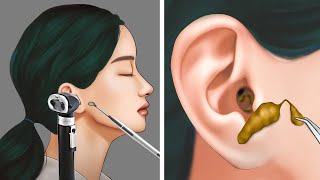 ASMR  Satisfying Ear Cleaning and Earwax Removal  ENJO Relaxing [upl. by Adihahs]