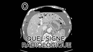 AEROPORTIE radiologystudent science femmemedecine [upl. by Gschu]