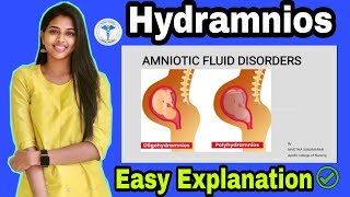 Hydramnios  Gynecology  Nursing Lecture  Easy Explanation  Nursing Association🔥 [upl. by Brey791]