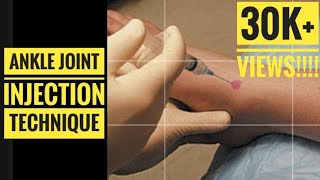 Ankle Joint Injection Aspiration Technique [upl. by Ailes]