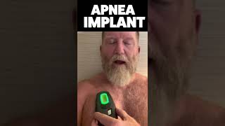 ⚡️Inspire Sleep Apnea Implant Activation By Doug shorts⚡️ [upl. by Imarej670]